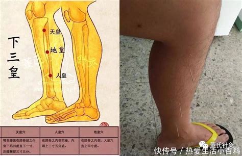 下三皇穴位|既补先天肾，又补后天脾的特效奇穴——下三皇